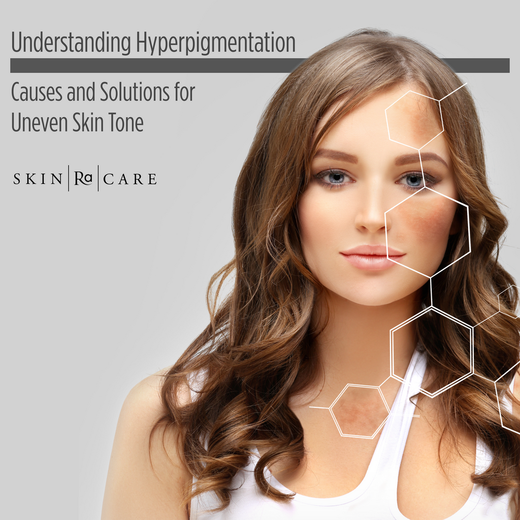 Purchase Rhonda Allison - Understanding Hyperpigmentation: Causes and ...