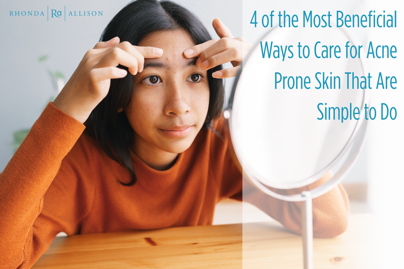 4 of the Most Beneficial Ways to Care for Acne Prone Skin That are Simple to Do